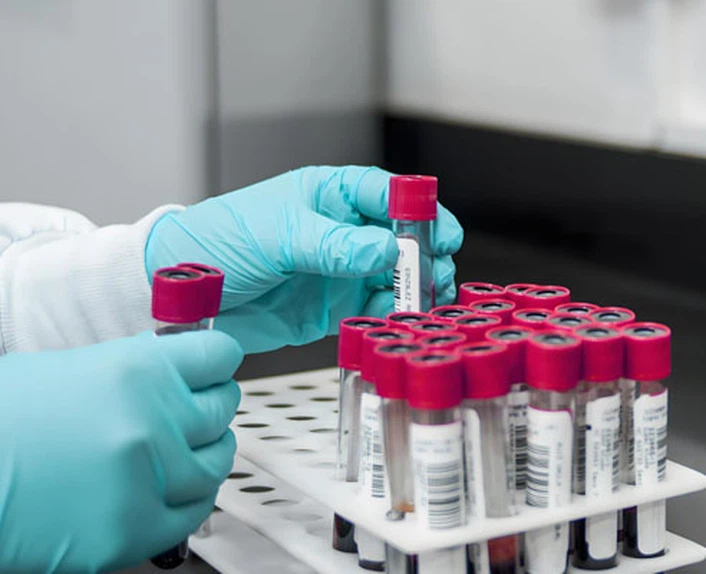 Best Glutathione Injection use | Shaanxi BLOOM Tech Co., Ltd Best Glutathione Injection use | Shaanxi BLOOM Tech Co., Ltd