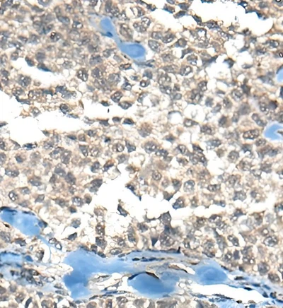 SLU-PP-332 Injection use| Shaanxi BLOOM Tech Co., Ltd SLU-PP-332 Injection use| Shaanxi BLOOM Tech Co., Ltd