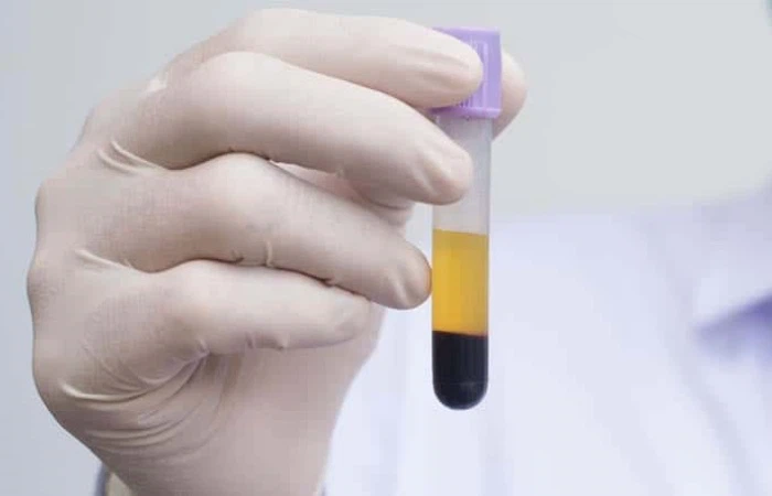 GS 441524 Serum Biochemistry Panel | Shaanxi BLOOM Tech Co., Ltd GS 441524 Serum Biochemistry Panel | Shaanxi BLOOM Tech Co., Ltd