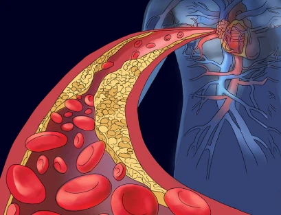 SLU-PP-332 Cost | Shaanxi BLOOM Tech Co., Ltd SLU-PP-332 Cost | Shaanxi BLOOM Tech Co., Ltd