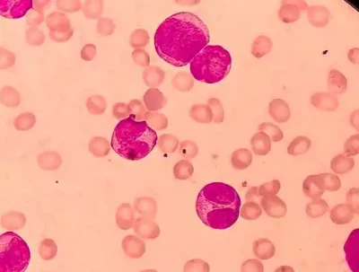 SLU-PP-332 Price | Shaanxi BLOOM Tech Co., Ltd SLU-PP-332 Price | Shaanxi BLOOM Tech Co., Ltd