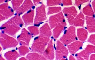 SLU-PP-332 500mcg | Shaanxi BLOOM Tech Co., Ltd SLU-PP-332 500mcg | Shaanxi BLOOM Tech Co., Ltd