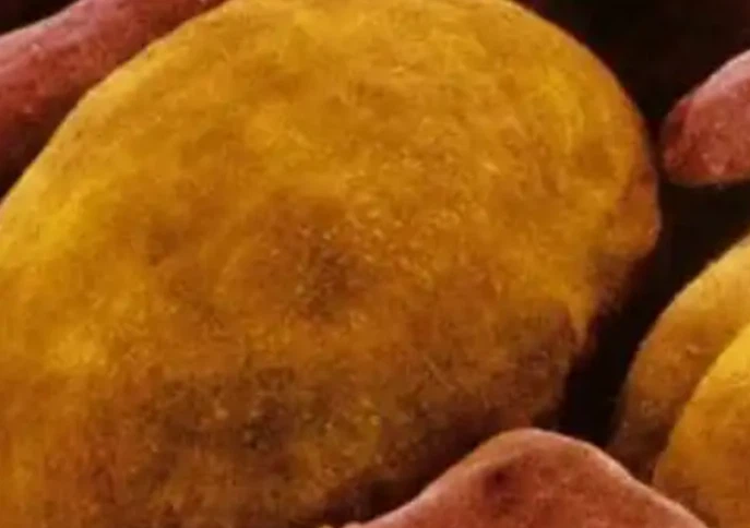 5-amino-1mq Metabolic Flexibility Investigations | Shaanxi BLOOM Tech Co., Ltd 5-amino-1mq Metabolic Flexibility Investigations | Shaanxi BLOOM Tech Co., Ltd