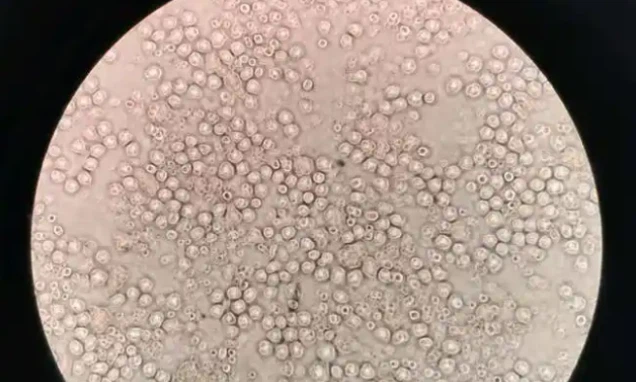 5-amino-1mq Dose Selection | Shaanxi BLOOM Tech Co., Ltd 5-amino-1mq Dose Selection | Shaanxi BLOOM Tech Co., Ltd