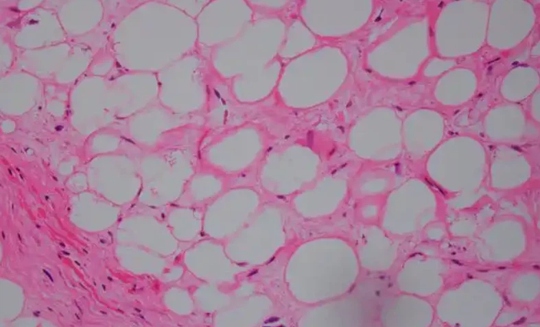 SLU-PP-332 uses | Shaanxi BLOOM Tech Co., Ltd SLU-PP-332 uses | Shaanxi BLOOM Tech Co., Ltd