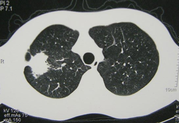 GS-441524 treating | Shaanxi BLOOM Tech Co., Ltd GS-441524 treating | Shaanxi BLOOM Tech Co., Ltd