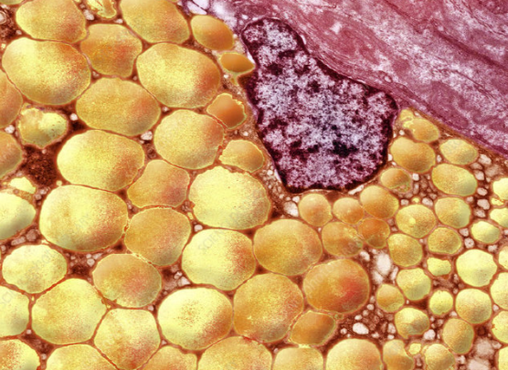 Bioglutide Metabolic flexibility | Shaanxi BLOOM Tech Co., Ltd Bioglutide Metabolic flexibility | Shaanxi BLOOM Tech Co., Ltd