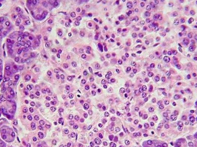 Bioglutide NA-931 500mcg | Shaanxi BLOOM Tech Co., Ltd Bioglutide NA-931 500mcg | Shaanxi BLOOM Tech Co., Ltd