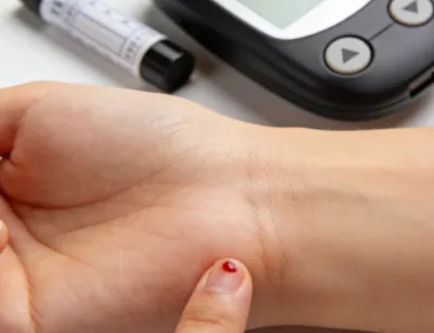 Bioglutide NA-931 Metabolic Benefits | Shaanxi BLOOM Tech Co., Ltd Bioglutide NA-931 Metabolic Benefits | Shaanxi BLOOM Tech Co., Ltd