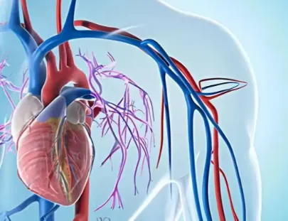 Bioglutide NA-931 Cardiometabolic Risk | Shaanxi BLOOM Tech Co., Ltd Bioglutide NA-931 Cardiometabolic Risk | Shaanxi BLOOM Tech Co., Ltd