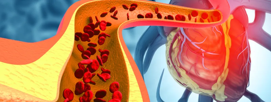 Bioglutide NA-931 Evidence | Shaanxi BLOOM Tech Co., Ltd Bioglutide NA-931 Evidence | Shaanxi BLOOM Tech Co., Ltd