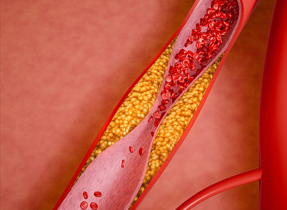 Retatrutide Factory | Shaanxi BLOOM Tech Co., Ltd Retatrutide Factory | Shaanxi BLOOM Tech Co., Ltd