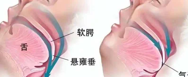 Peptide Drug | Shaanxi BLOOM Tech Co., Ltd Peptide Drug | Shaanxi BLOOM Tech Co., Ltd