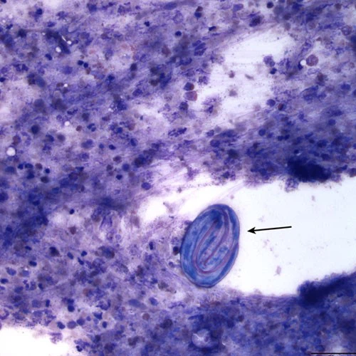 4-(4-Nitrobenzyl)pyridine use | Shaanxi BLOOM Tech Co., Ltd 4-(4-Nitrobenzyl)pyridine use | Shaanxi BLOOM Tech Co., Ltd