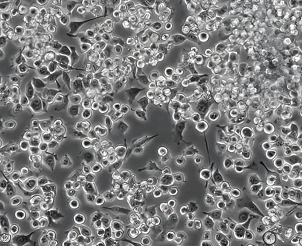 Huperzine A Tablet Supply | Shaanxi BLOOM Tech Co., Ltd Huperzine A Tablet Supply | Shaanxi BLOOM Tech Co., Ltd