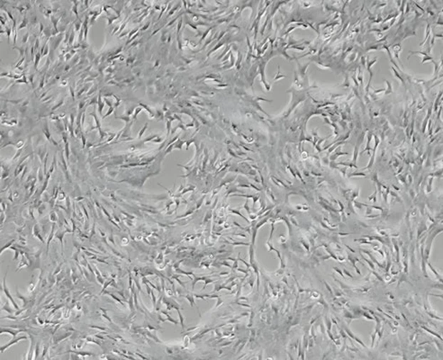 Huperzine A Tablet Factory | Shaanxi BLOOM Tech Co., Ltd Huperzine A Tablet Factory | Shaanxi BLOOM Tech Co., Ltd