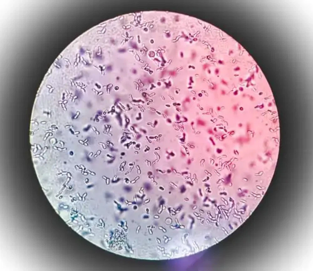 Carisoprodol use | Shaanxi BLOOM Tech Co., Ltd Carisoprodol use | Shaanxi BLOOM Tech Co., Ltd