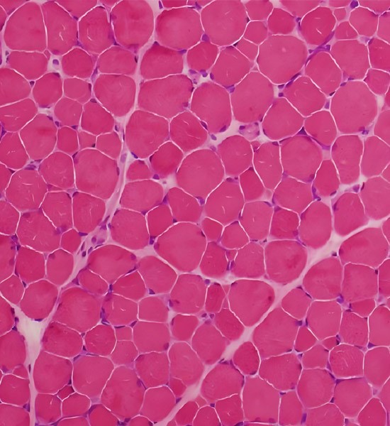 PEG-MGF Stability | Shaanxi BLOOM Tech Co., Ltd PEG-MGF Stability | Shaanxi BLOOM Tech Co., Ltd