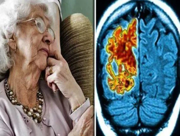 Huperzine A Cost | Shaanxi BLOOM Tech Co., Ltd 