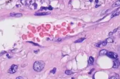 Aviptadil 500mcg | Shaanxi BLOOM Tech Co., Ltd Aviptadil 500mcg | Shaanxi BLOOM Tech Co., Ltd