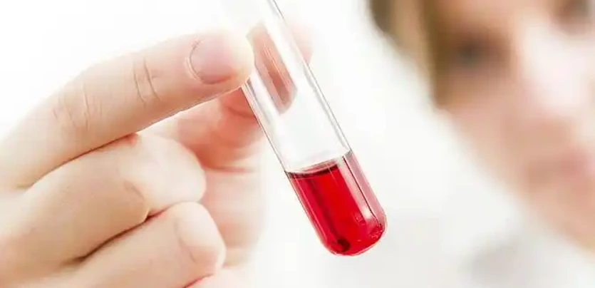 Dioctyl sebacate textile | Shaanxi BLOOM Tech Co., Ltd Dioctyl sebacate textile | Shaanxi BLOOM Tech Co., Ltd