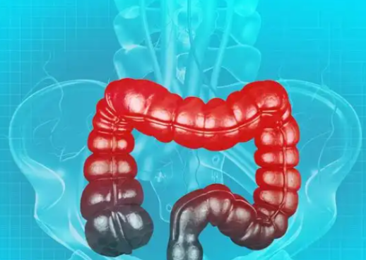 Teduglutide Chronic Intestinal Failure | Shaanxi BLOOM Tech Co., Ltd Teduglutide Chronic Intestinal Failure | Shaanxi BLOOM Tech Co., Ltd