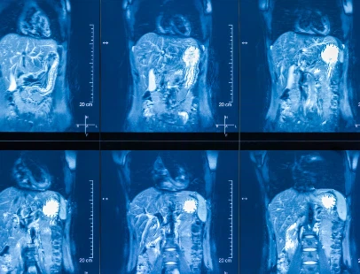 VIP Cost | Shaanxi BLOOM Tech Co., Ltd  