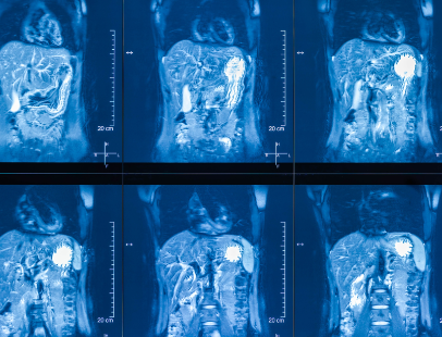 VIP Cost | Shaanxi BLOOM Tech Co., Ltd VIP Cost | Shaanxi BLOOM Tech Co., Ltd