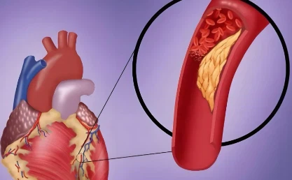 VIP Cost | Shaanxi BLOOM Tech Co., Ltd  
