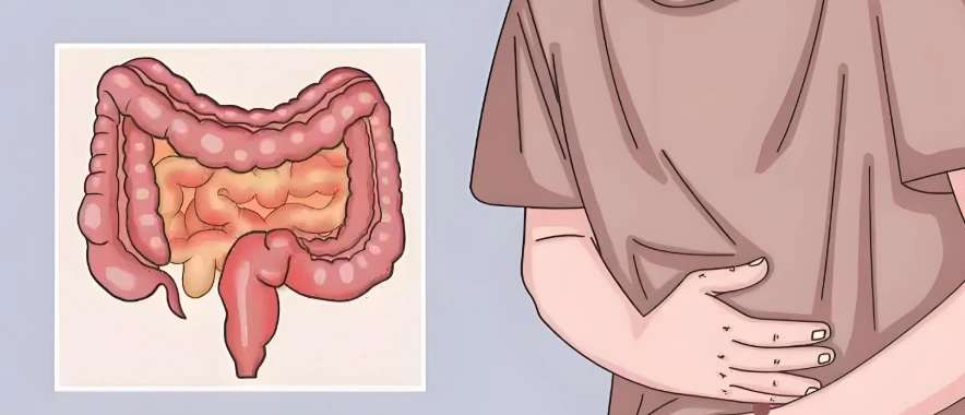 Teduglutide Clinical studies | Shaanxi BLOOM Tech Co., Ltd Teduglutide Clinical studies | Shaanxi BLOOM Tech Co., Ltd