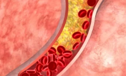 VIP Online | Shaanxi BLOOM Tech Co., Ltd