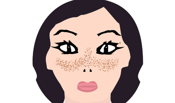 Uvinul A Plus skin | Shaanxi BLOOM Tech Co., Ltd Uvinul A Plus skin | Shaanxi BLOOM Tech Co., Ltd