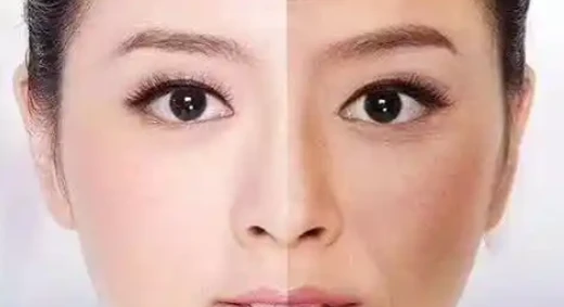Decapeptide-12 Core Skin Concerns | Shaanxi BLOOM Tech Co., Ltd