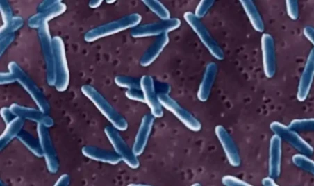 Metronidazole surgery | Shaanxi Bloom Tech Metronidazole surgery | Shaanxi Bloom Tech