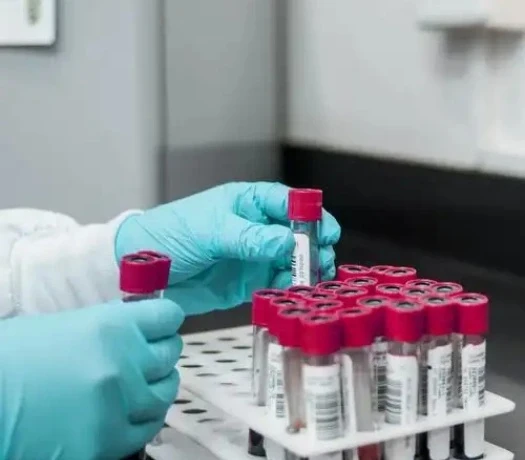 Lyophilized peptide sale | Bloomtechz Lyophilized peptide sale | Bloomtechz